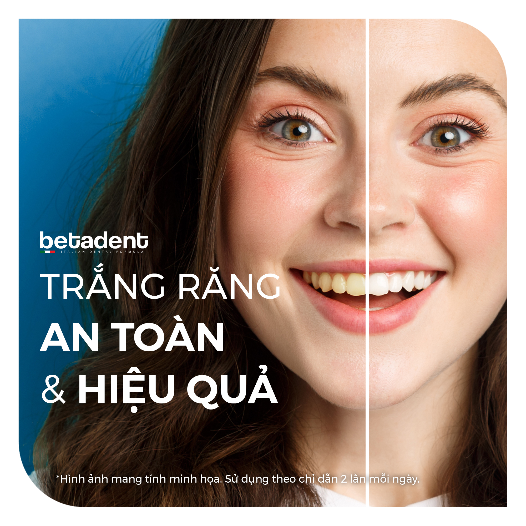Trắng Răng An Toàn Hiệu Quả